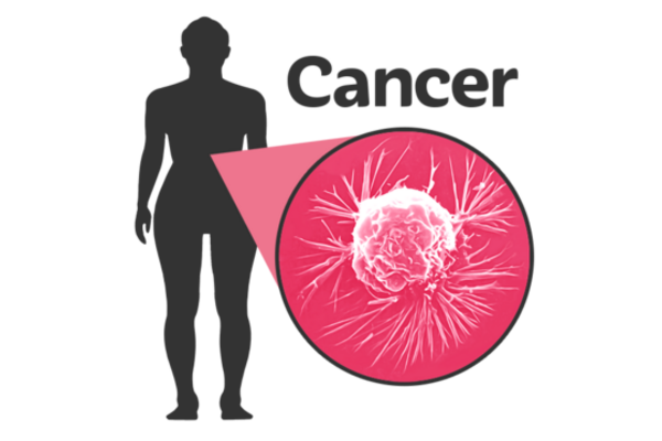 The image shows a blacked out body with a pink bubble pointed at the middle of the body, with the word cancer above the bubble.
