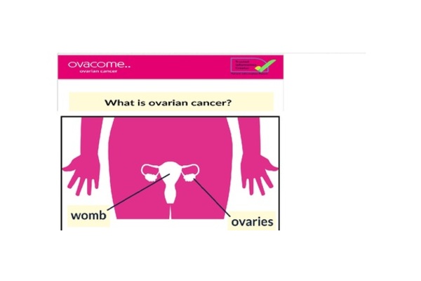 The image is of a womb and ovaries, with the the words "what is ovarian cancer?" above it