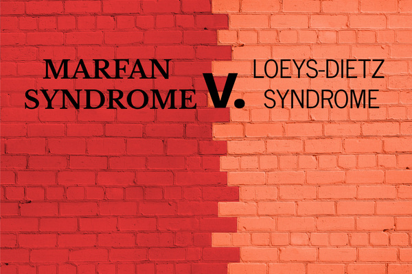 Marfan Syndrome V. Loeys-Dietz Syndrome